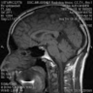 Meet your Posher, Alexander